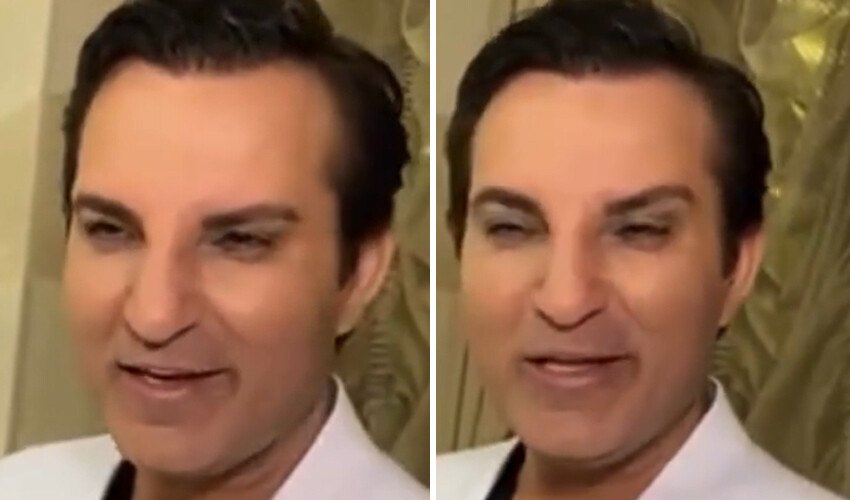 Önce ‘Botoks yaptırdım’ dedi, sonra inkar etti! Rafet El Roman’dan şaşırtan estetik tepkisi