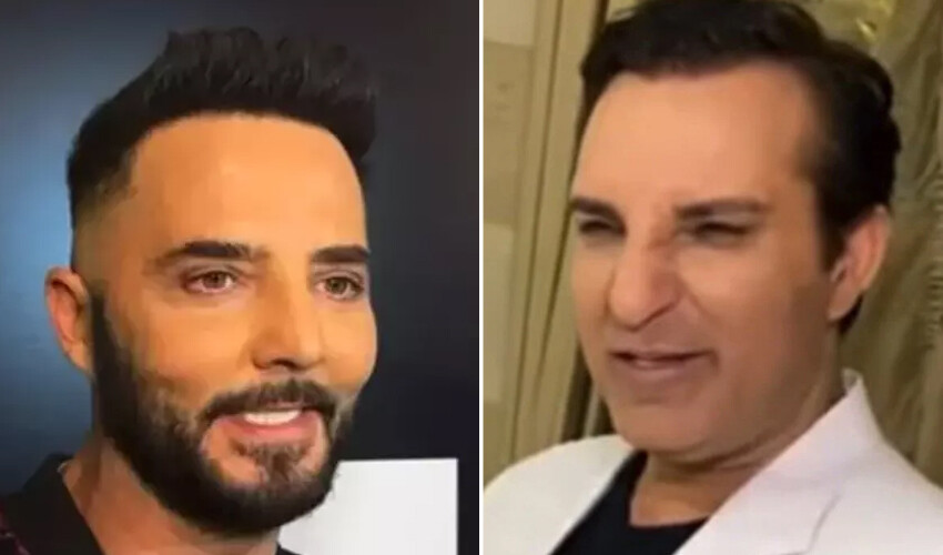 Alişan ve eşi Buse Varol estetik yaptıranlarla dalga geçti