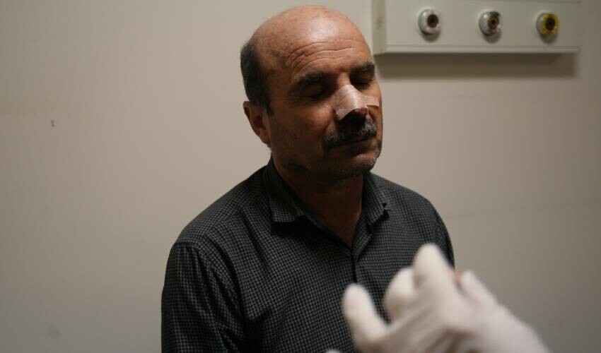 Muş'ta sokak köpeği dehşeti: Namaza giden adama saldırıp, yüzünü parçaladılar! Muş'ta sokak köpeği dehşeti: Namaza giden adama saldırıp, yüzünü parçaladılar!