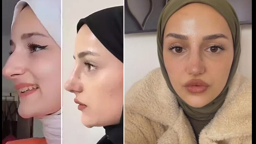 'Amin amin' videosu ile tanınan fenomen Gizem Yıldız'ın eski hali ağızları açık bıraktı 'Amin amin' videosu ile tanınan fenomen Gizem Yıldız'ın eski hali ağızları açık bıraktı