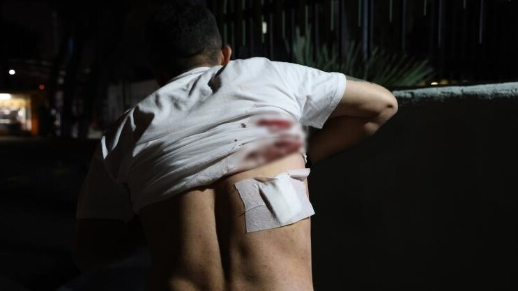 İzmir'de bir taksici daha dehşeti yaşadı! Sırtına makas saplandı, 'sıra bize mi geldi' dedi İzmir'de bir taksici daha dehşeti yaşadı! Sırtına makas saplandı, 'sıra bize mi geldi' dedi