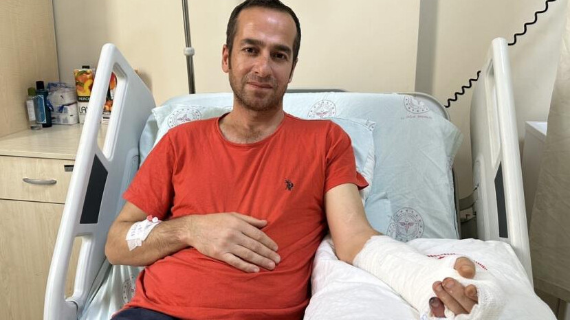 Devrim gibi ameliyat: Kopan parmakları karnına gömülerek kurtarıldı