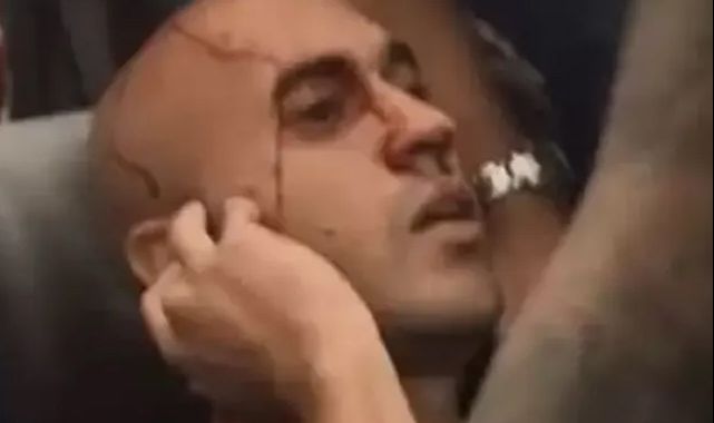 Daha önce böylesi görülmedi! Takım otobüsüne bombalı saldırı Daha önce böylesi görülmedi! Takım otobüsüne bombalı saldırı - 2. Resim