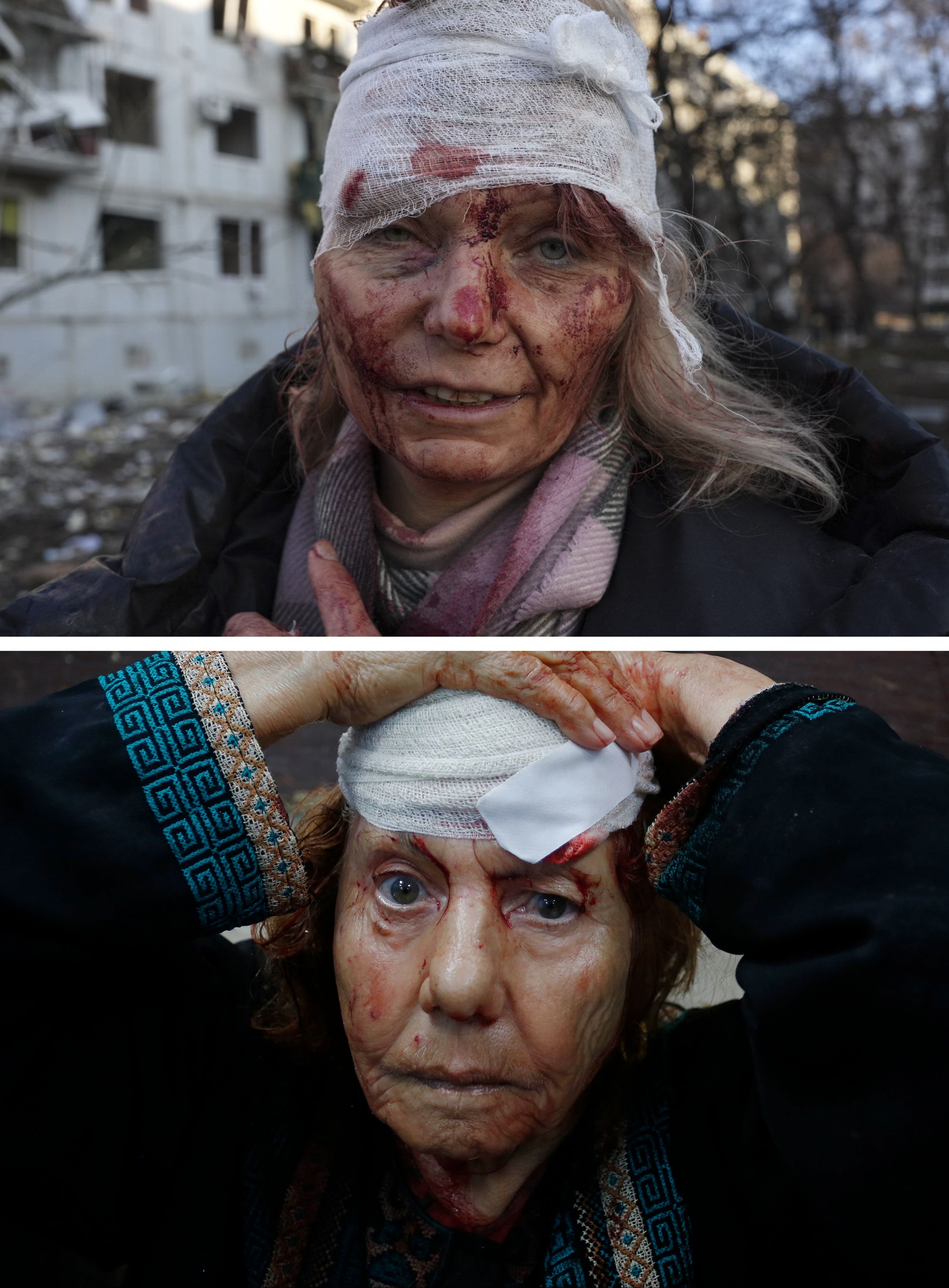 Bir tarafta Gazze, diğer tarafta Ukrayna... Savaş farklı, değişmeyen tek şey kareler Bir tarafta Gazze, diğer tarafta Ukrayna... Savaş farklı, değişmeyen tek şey kareler - 1. Resim