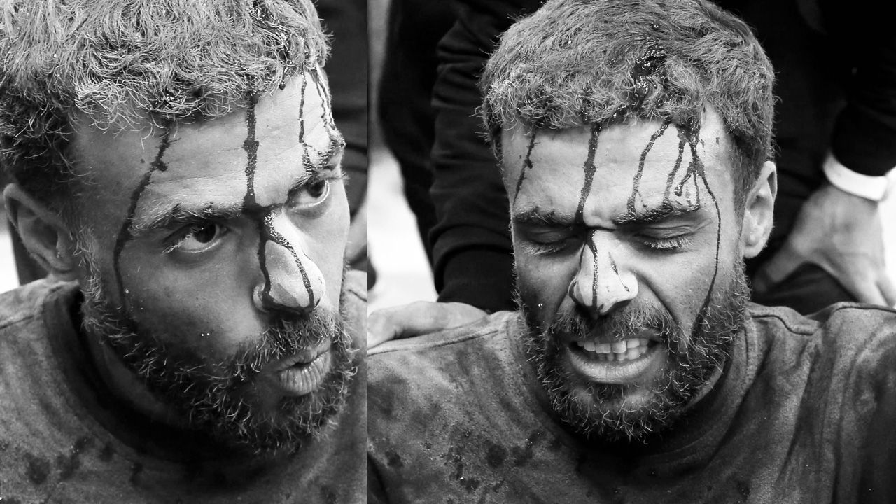 İsrail bir kez daha Gazze'de masumları vurdu: 40 ölü, 100 yaralı İsrail bir kez daha Gazze'de masumları vurdu: 40 ölü, 100 yaralı - 4. Resim