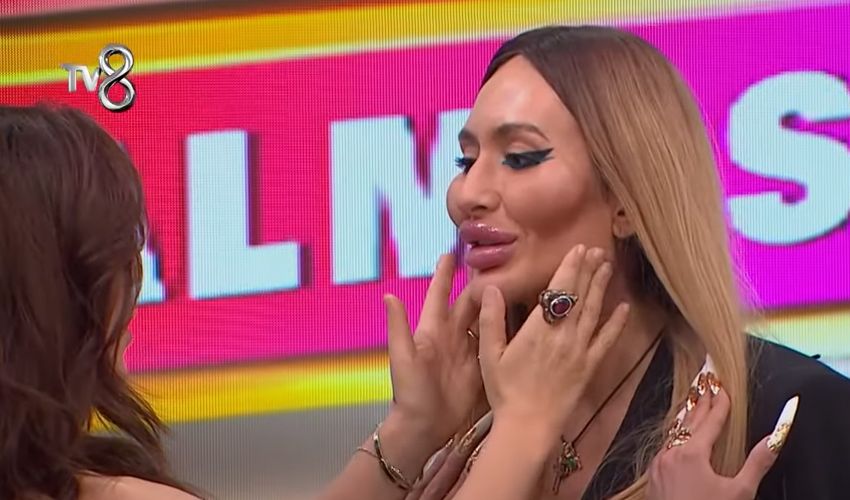 Estetik bağımlısı model Anastasia Pokreshchuk gerçek mesleğini açıkladı, duyanlar çok şaşırdı Estetik bağımlısı model Anastasia Pokreshchuk gerçek mesleğini açıkladı, duyanlar çok şaşırdı - 1. Resim