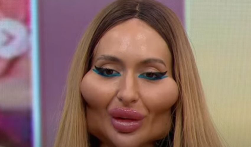 Estetik bağımlısı model Anastasia Pokreshchuk gerçek mesleğini açıkladı, duyanlar çok şaşırdı Estetik bağımlısı model Anastasia Pokreshchuk gerçek mesleğini açıkladı, duyanlar çok şaşırdı - 2. Resim