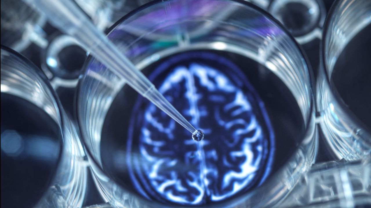 Türkiye’de 70 yaş üstü her 5 kişide bu hastalık var! Uzmanlar artan 'alzheimer'a karşı uyarıyor Türkiye’de 70 yaş üstü her 5 kişide bu hastalık var! Uzmanlar artan 'alzheimer'a karşı çözüm yollarını anlattı - 5. Resim