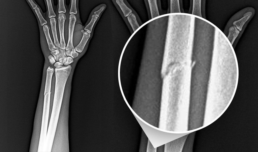 Paul Onuachu'nun kolu kırıldı, Trabzonspor tepki gösterdi: Adaletiniz batsın - 1. Resim