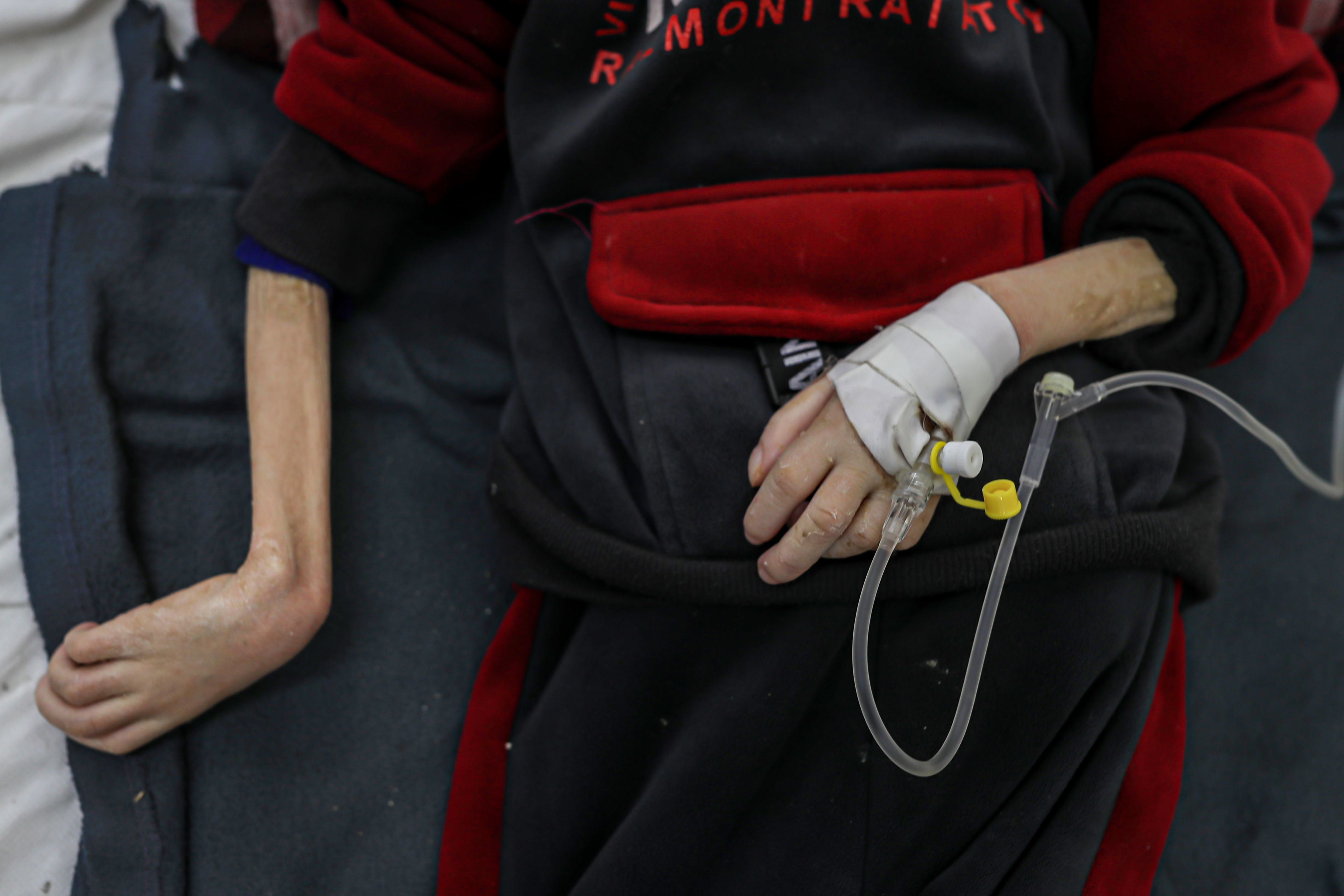 Gazze'de 10 yaşındaki Yezen Al-Kfarna da açlık silahıyla ölmek üzere... Gazze'de 10 yaşındaki Yezen Al-Kfarna da açlık silahıyla ölmek üzere... - 3. Resim