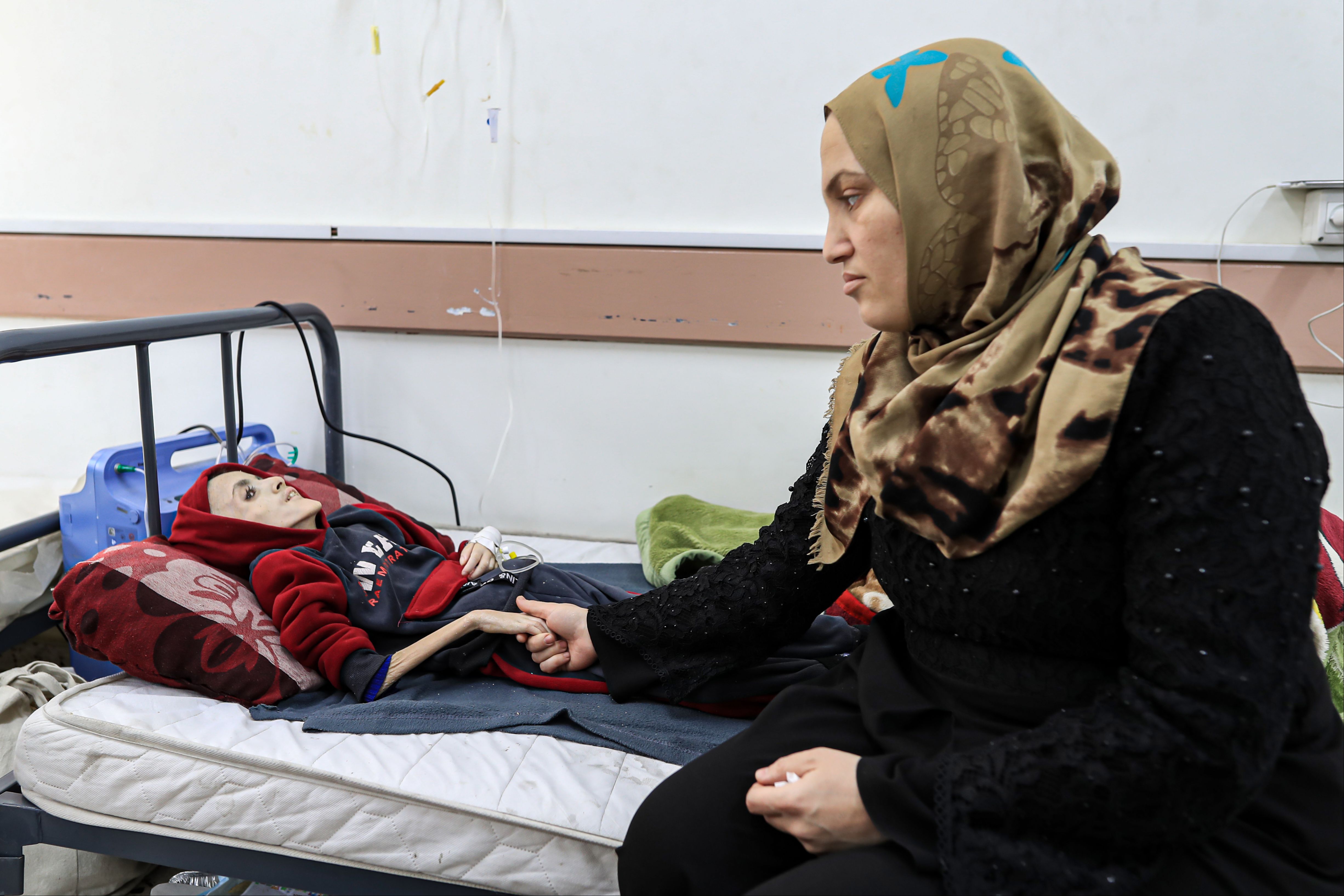 Gazze'de 10 yaşındaki Yezen Al-Kfarna da açlık silahıyla ölmek üzere... Gazze'de 10 yaşındaki Yezen Al-Kfarna da açlık silahıyla ölmek üzere... - 2. Resim