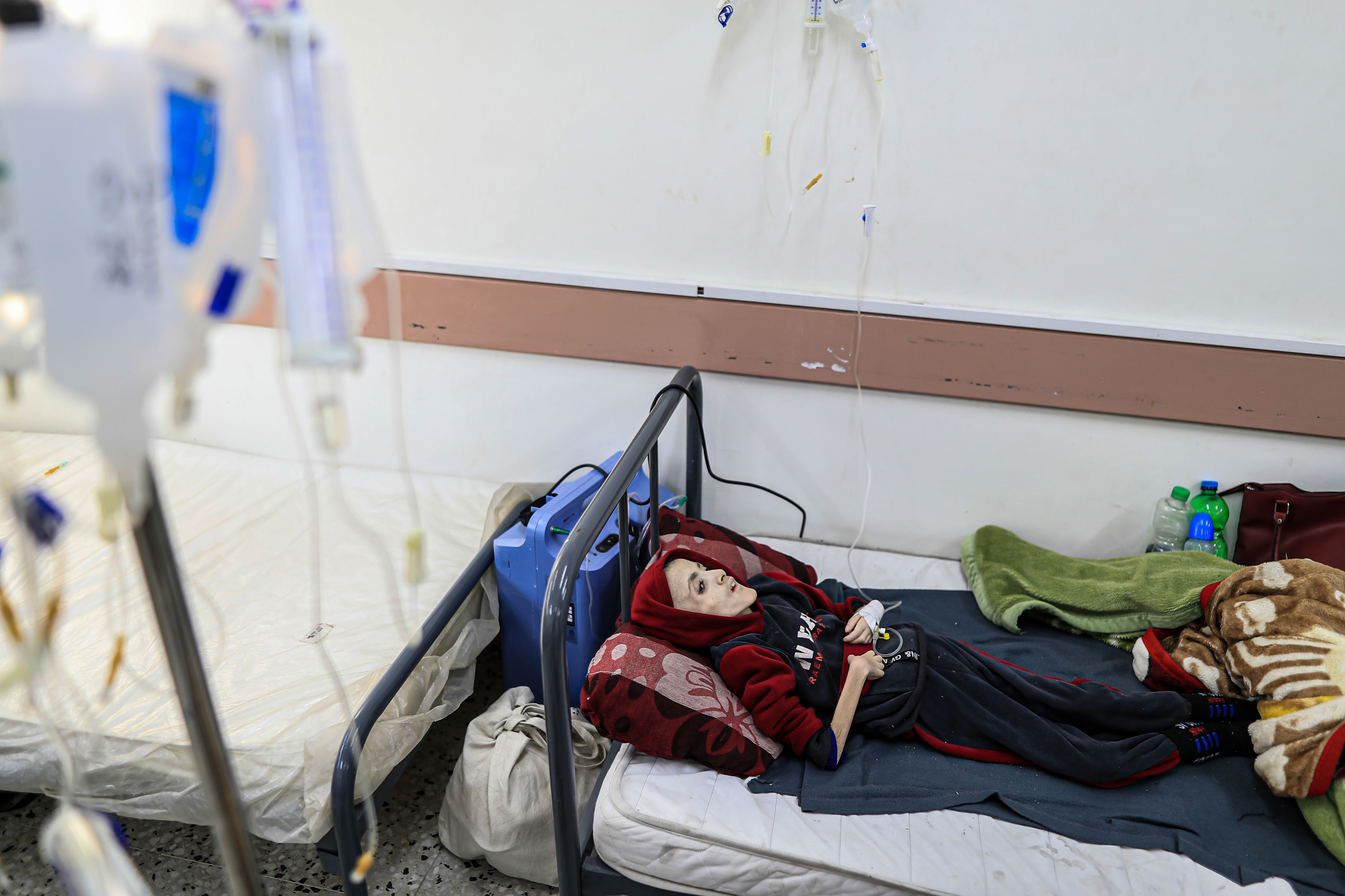 Gazze'de 10 yaşındaki Yezen Al-Kfarna da açlık silahıyla ölmek üzere... Gazze'de 10 yaşındaki Yezen Al-Kfarna da açlık silahıyla ölmek üzere... - 1. Resim