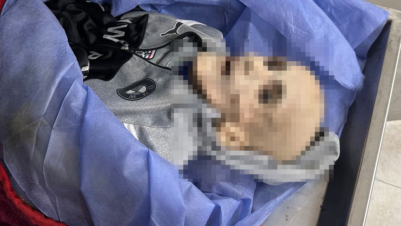 Bu senin eserin katil İsrail: Gazze'deki dehşetten en çarpıcı kare! Bu senin eserin katil İsrail: Gazze'deki dehşetten en çarpıcı kare! - 1. Resim