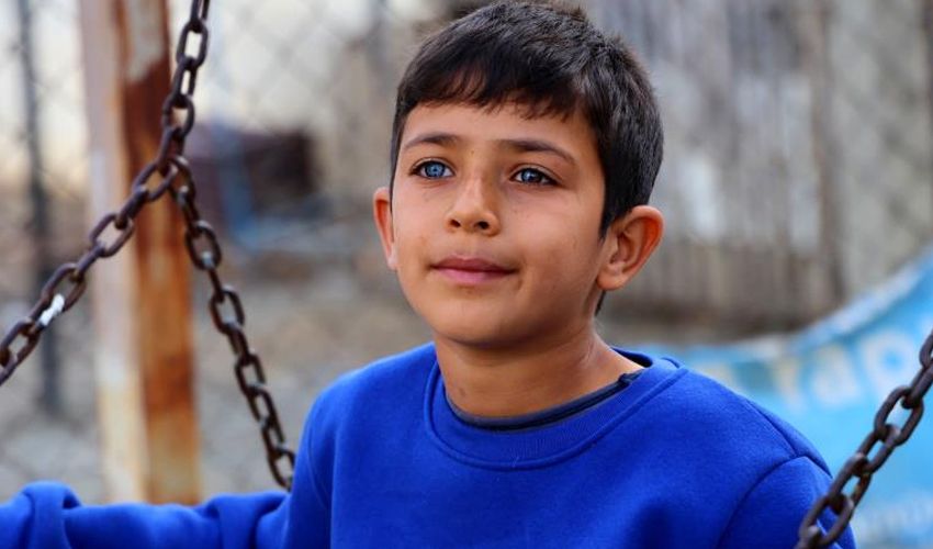 Bir g&ouml;z&uuml; mavi, diğeri &ccedil;ift renk: G&ouml;renler hayrete d&uuml;ş&uuml;yor! &lsquo;Allah&rsquo;ın takdiri&rsquo; - 3. Resim