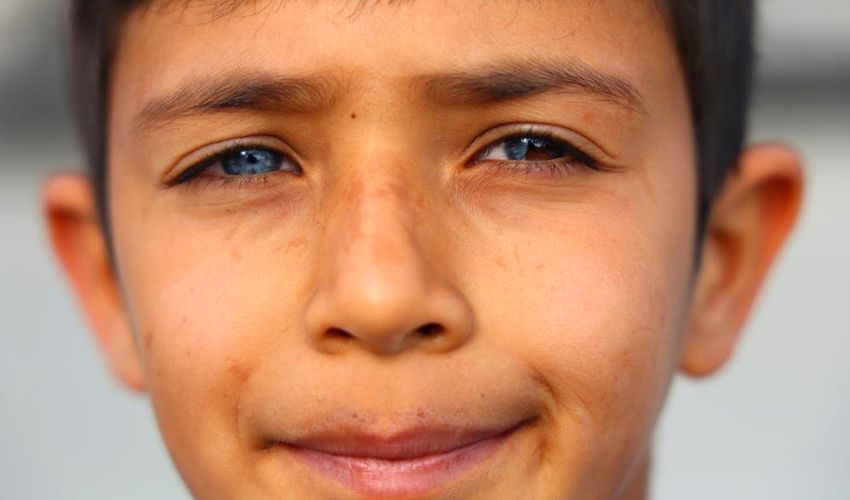 Bir g&ouml;z&uuml; mavi, diğeri &ccedil;ift renk: G&ouml;renler hayrete d&uuml;ş&uuml;yor! &lsquo;Allah&rsquo;ın takdiri&rsquo; - 2. Resim