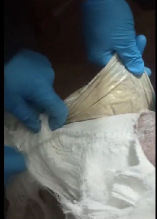 Kırık değil zehir çıktı! Alçılı ayağından eroin fışkırdı - 1. Resim