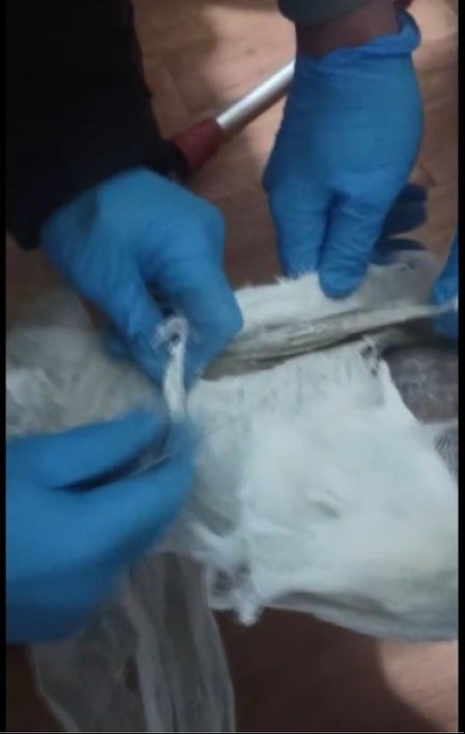 Kırık değil zehir çıktı! Alçılı ayağından eroin fışkırdı - 1. Resim