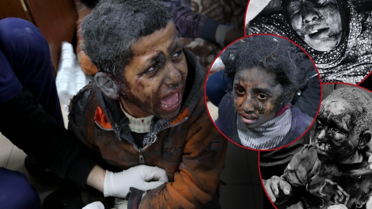 Gazze'den son gelişmeler... İsrail'in alçak saldırıları sürüyor! Kadın-çocuk demeden vurdular - 1. Resim