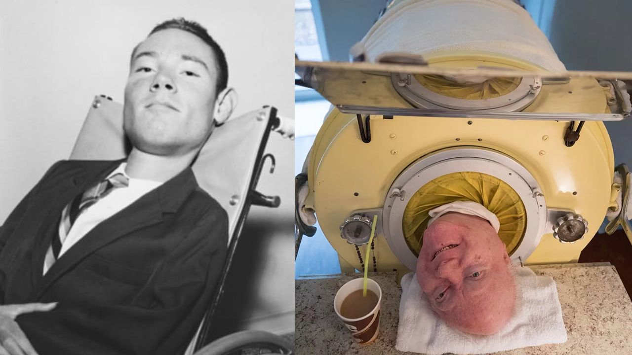 Altı yaşında çocuk felci geçirdi... 72 yıl boyunca bu tankın içinde yaşadı Altı yaşında çocuk felci geçirdi... 72 yıl boyunca bu tankın içinde yaşadı - 1. Resim