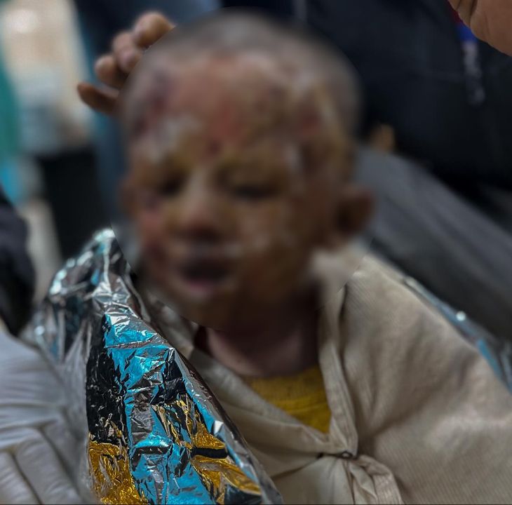 Çocukluğunu yaşayamadı... Gazzeli 4 yaşındaki Seca Cuneyd’in yürek yakan çığlıkları - 1. Resim