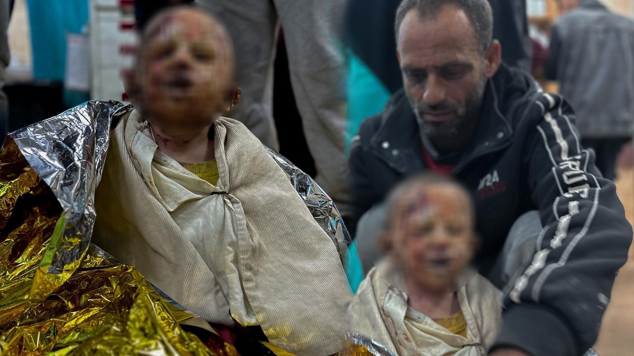 Çocukluğunu yaşayamadı... Gazzeli 4 yaşındaki Seca Cuneyd’in yürek yakan çığlıkları - 2. Resim