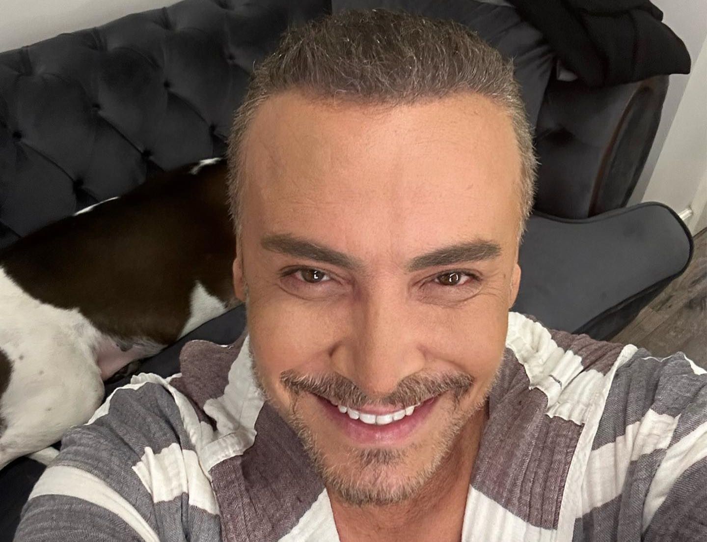 Değişimiyle ağızları açık bırakan Cenk Eren'in estetik için ödediği ücret ortaya çıktı - 1. Resim