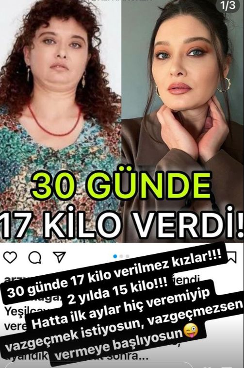 30 günde 17 kilo mu verdi? Nurgül Yeşilçay sosyal medyadaki iddiaları cevapsız bırakmadı - 1. Resim