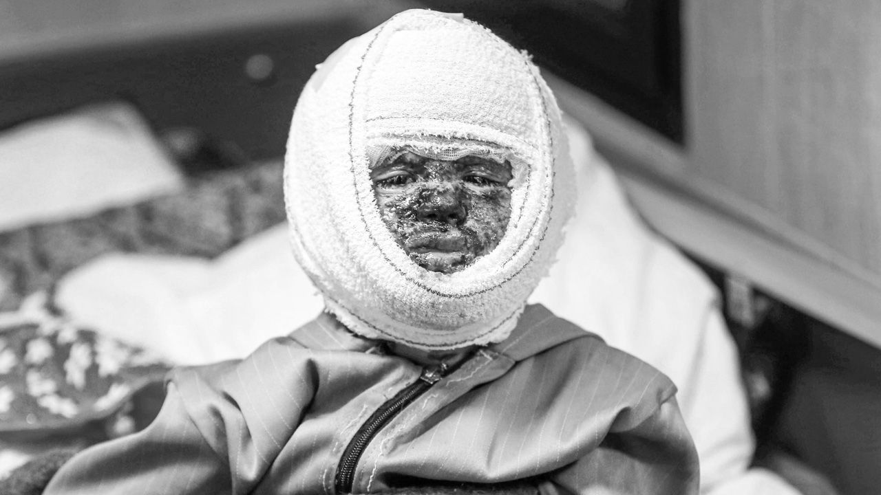 Gazze'de son durum... İsrail vahşeti! 4 yaşındaki çocuğu hastanede de rahat bırakmadılar - 1. Resim