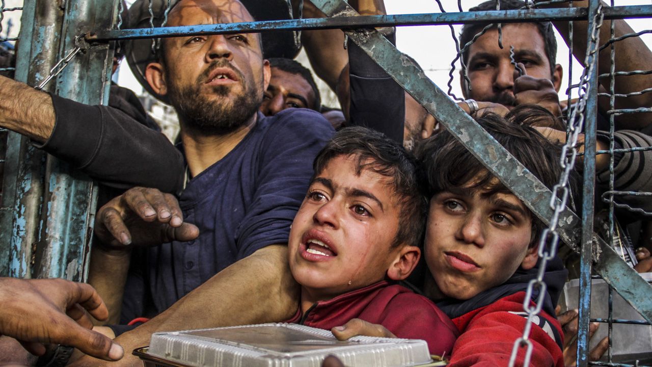 Gazze'de son durum... İsrail vahşeti! 4 yaşındaki çocuğu hastanede de rahat bırakmadılar - 1. Resim