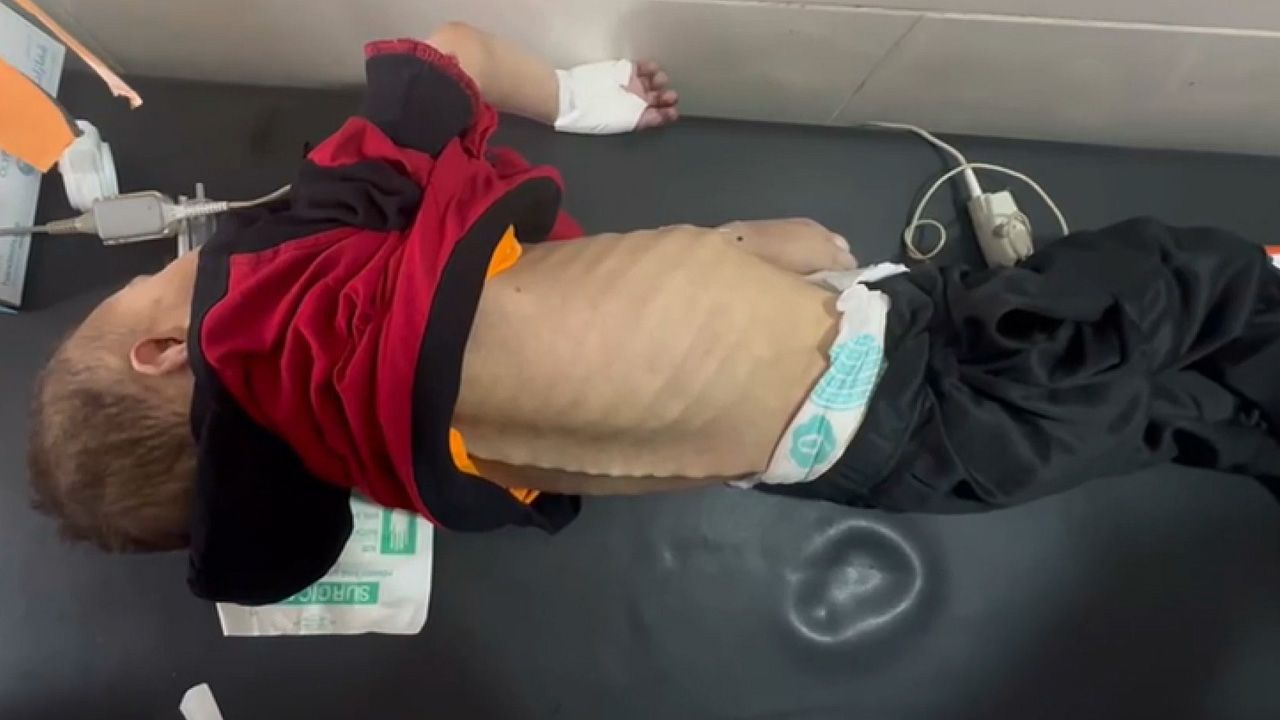 Gazze'de son durum... İsrail vahşeti! 4 yaşındaki çocuğu hastanede de rahat bırakmadılar - 1. Resim