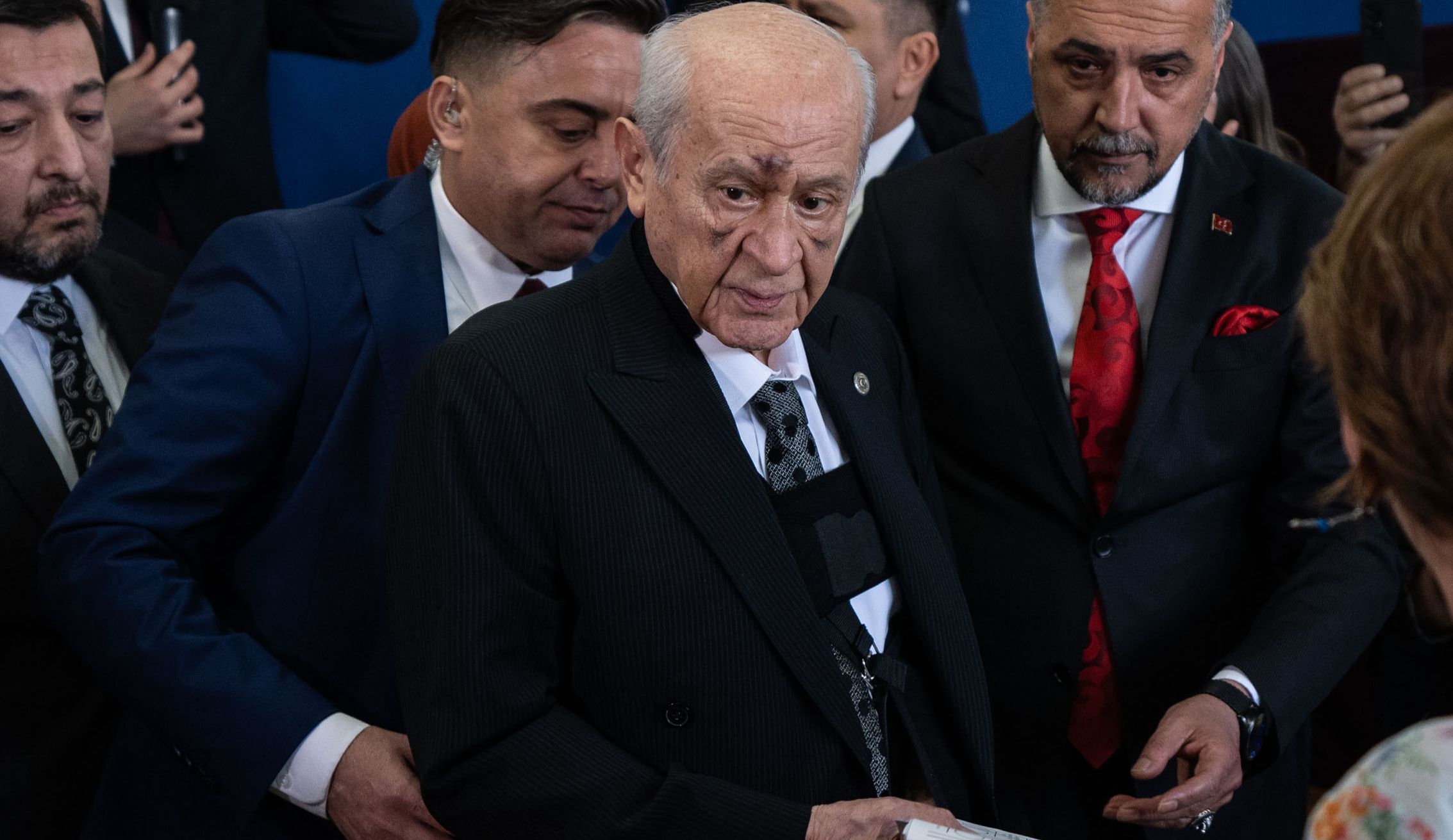 Devlet Bahçeli'nin yüzündeki morluklar dikkat çekmişti! Sebebi ortaya çıktı Devlet Bahçeli'nin yüzündeki morluklar dikkat çekmişti! Sebebi ortaya çıktı - 1. Resim