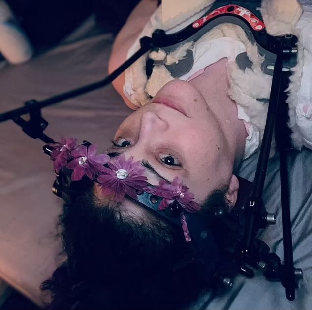 Kafası omurgasından kopmasın diye yıllarca sırt &uuml;st&uuml; yattı! Tıp tarihine ge&ccedil;en ameliyat yaşamını değiştirdi - 1. Resim