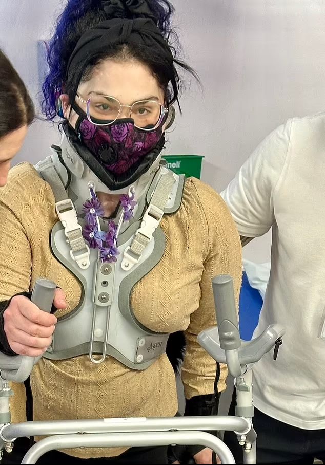 Kafası omurgasından kopmasın diye yıllarca sırt &uuml;st&uuml; yattı! Tıp tarihine ge&ccedil;en ameliyat yaşamını değiştirdi - 3. Resim