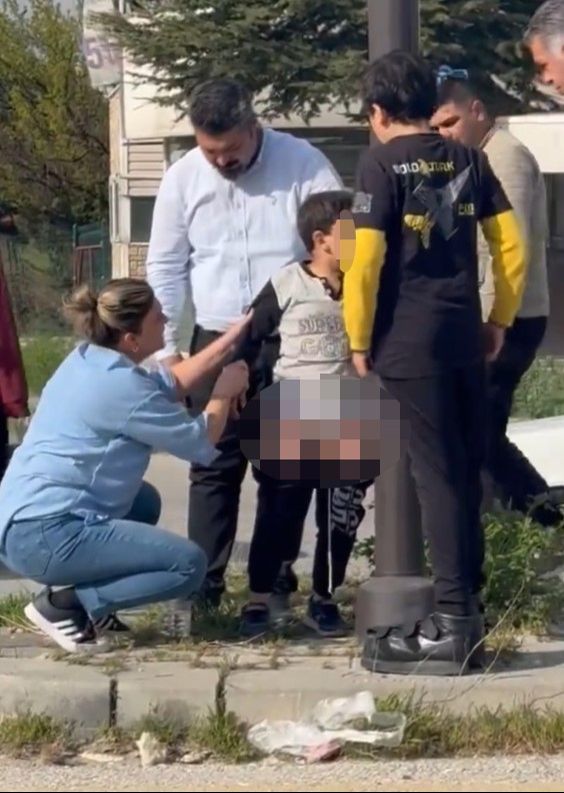 Ankara’da başıboş köpek dehşeti! Şoka giren çocuk uzun süre kendine gelemedi Ankara’da başıboş köpek dehşeti! Şoka giren çocuk uzun süre kendine gelemedi - 1. Resim