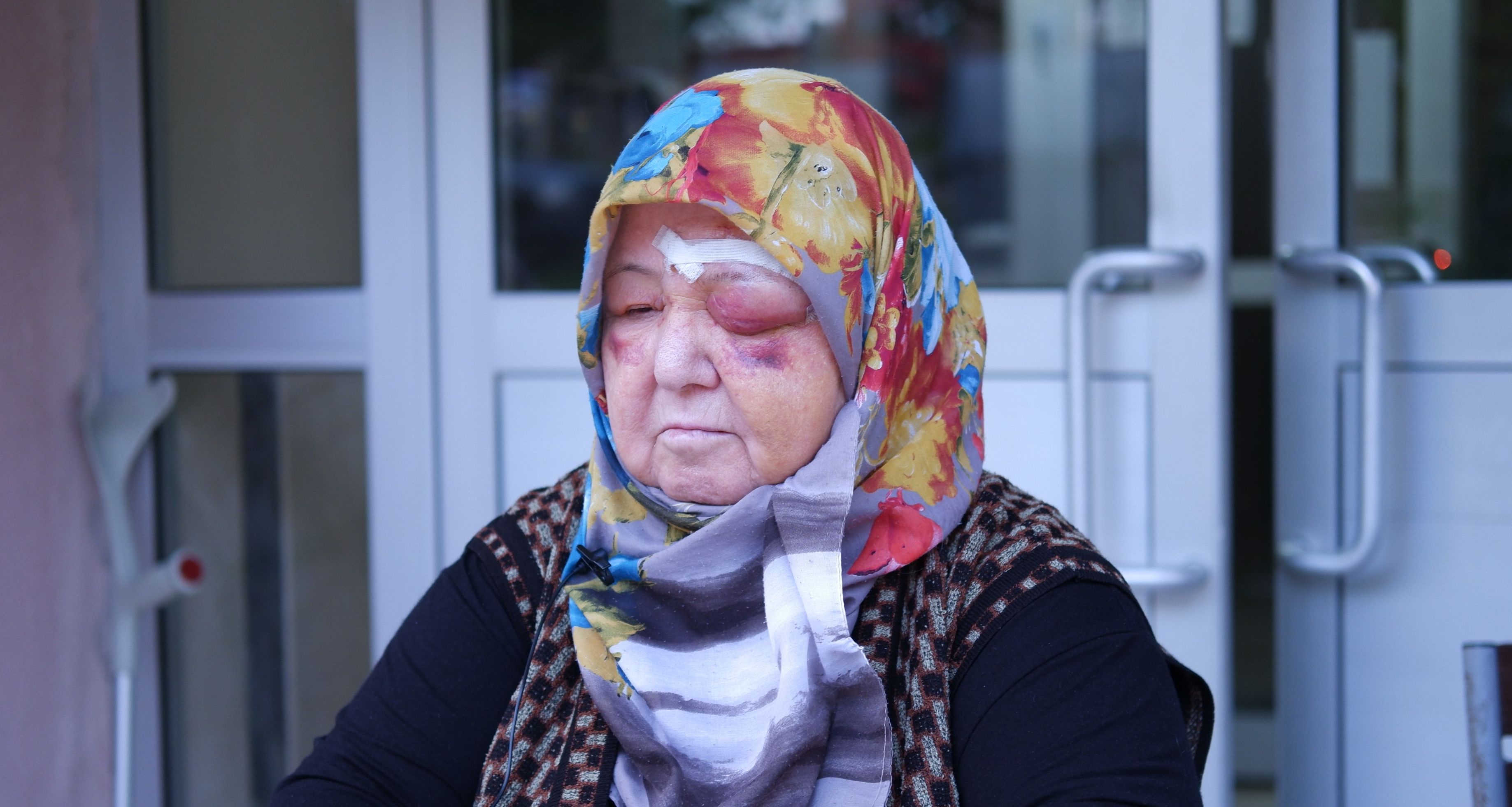 Başıboş köpek dehşeti! Yaşlı kadın tanınmaz hale geldi Başıboş köpek dehşeti! Yaşlı kadın tanınmaz hale geldi - 2. Resim