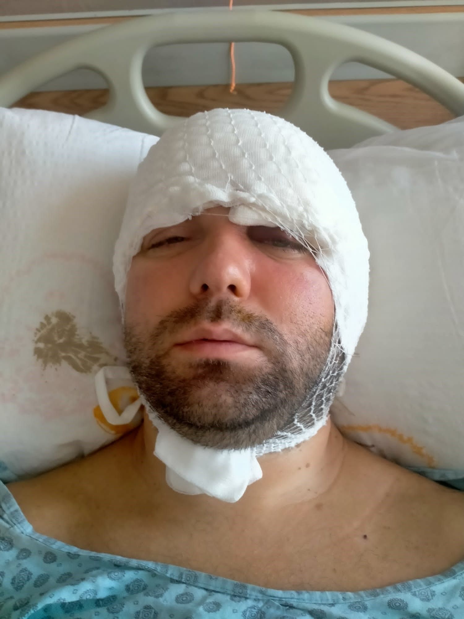 Bursa'da kan donduran olay! Amerika'da dergilere konu oldu... Dişini yaptırmak istedi, ölümden döndü Bursa'da kan donduran olay! Amerika'da dergilere konu oldu... Dişini yaptırmak istedi, ölümden döndü - 3. Resim