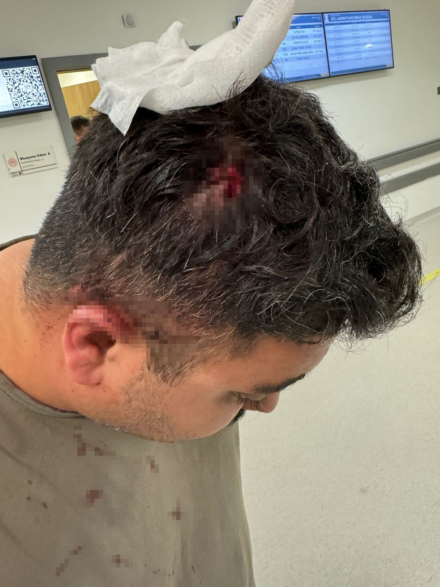 Bekçi ile boksör arasında pitpull kavgası! Sopayı alıp başına geçirdi - 2. Resim