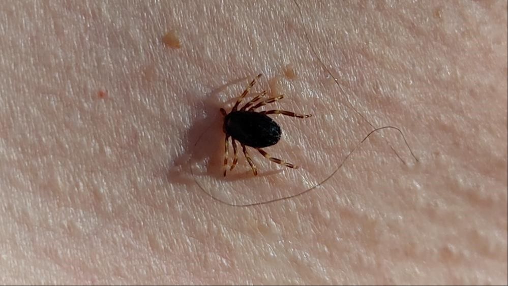 Ölümcül virüs geri döndü! Yılın ilk kene vakası Gümüşhane'de görüldü Ölümcül virüs geri döndü! Yılın ilk kene vakası Gümüşhane'de görüldü - 1. Resim