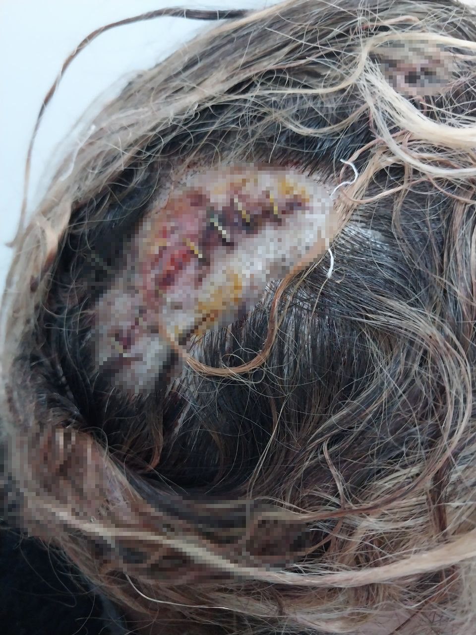 Tokat'ta park kavgası kanlı bitti: Magandalar, kadını hastanelik etti - 3. Resim