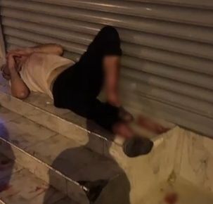 Evden kaçan pitbull dehşet saçtı! Sahibini ve 2 kişiyi yaraladı - 1. Resim