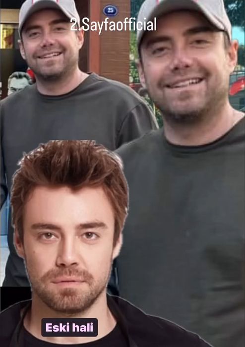 Burnundan 9. kez ameliyat olan Murat Dalkılıç ilk kez görüntülendi - 2. Resim