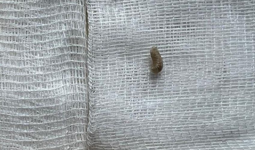 Ağrı şikayetiyle gitti, kulağından canlı kurtçuk çıkarıldı - 2. Resim