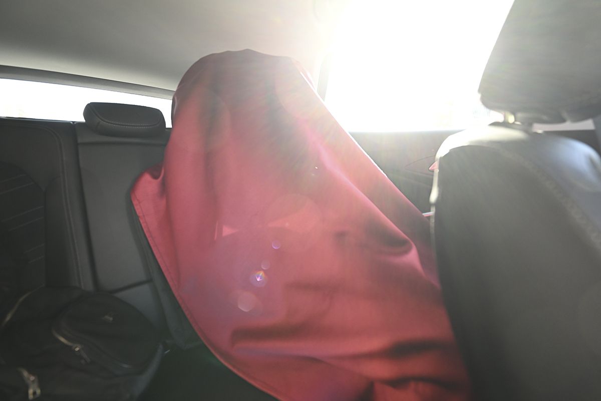 Genetik XP hastası olan kardeşler gün ışığına hasret - 3. Resim