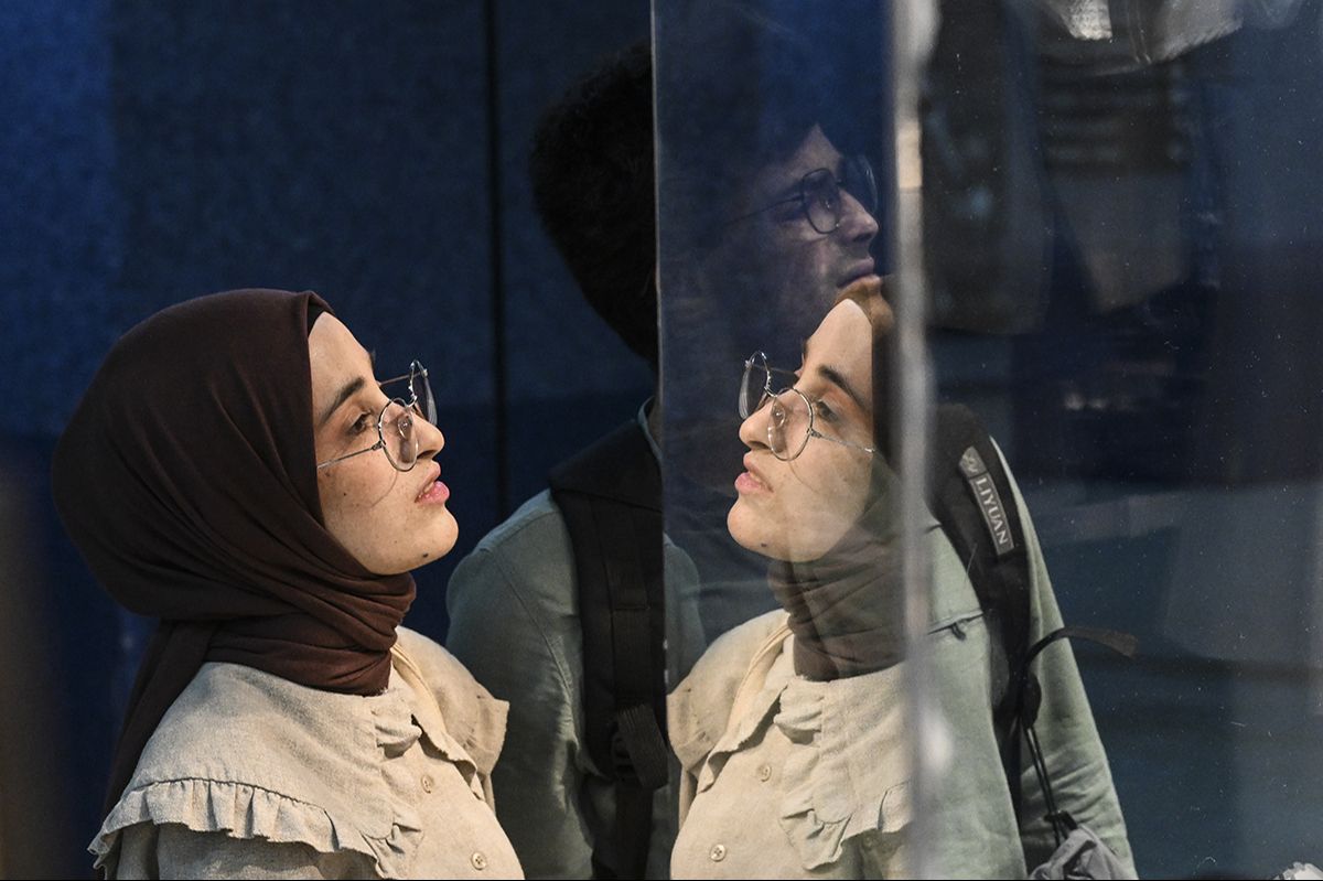 Genetik XP hastası olan kardeşler gün ışığına hasret - 3. Resim