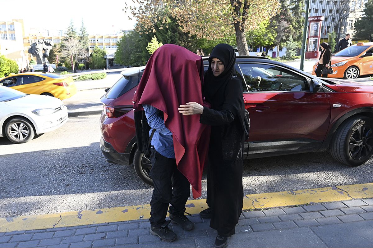 Genetik XP hastası olan kardeşler gün ışığına hasret - 1. Resim