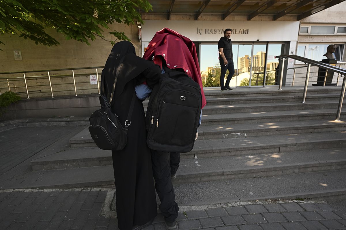 Genetik XP hastası olan kardeşler gün ışığına hasret - 10. Resim