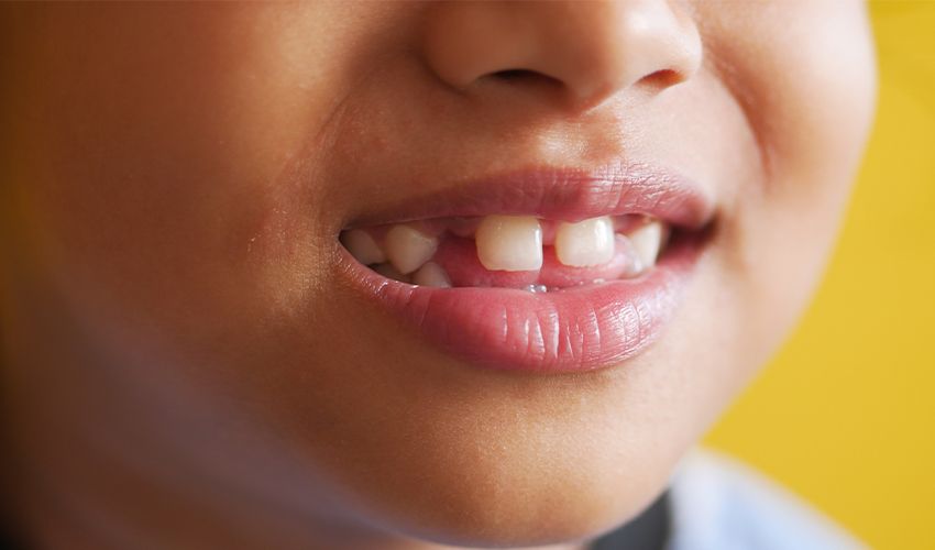 Anne babalara uyarı: Bu üçü varsa hiç beklemeyin Anne babalara uyarı: Bu üçü varsa hiç beklemeyin - 1. Resim