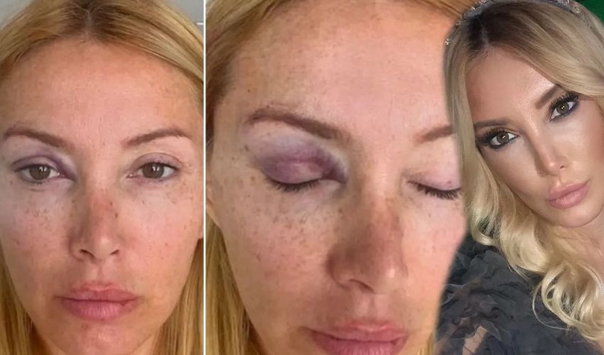 Eşinden şiddet gördüğünü açıklamıştı: Yeşim Erçetin’in kocası hayatını kaybetti - 2. Resim