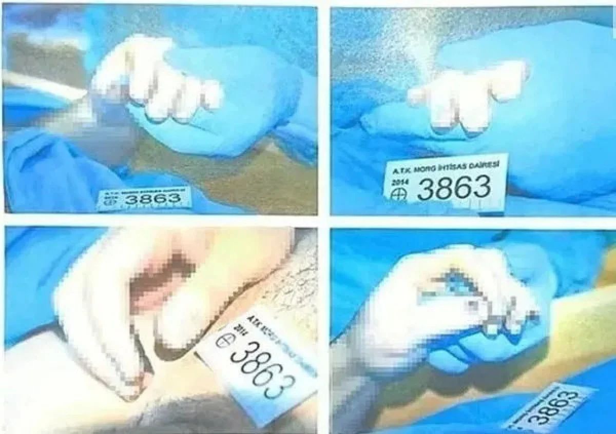 Cem Garipoğlu'nun parmağındaki morlukların sırrı çözüldü - 2. Resim