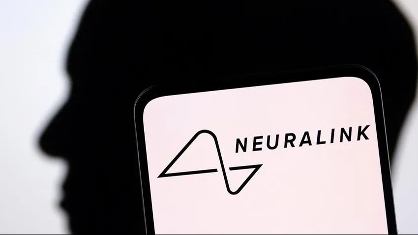 Elon Musk'ın Neuralink projesinde Arıza: İlk implantlı hastada sorunlar başladı! - 1. Resim